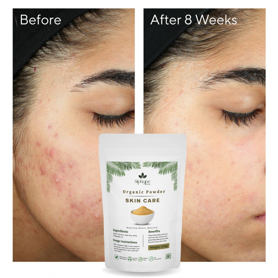 2-before after