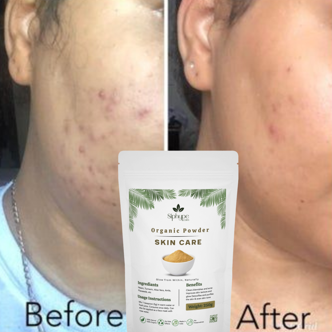 6-before after