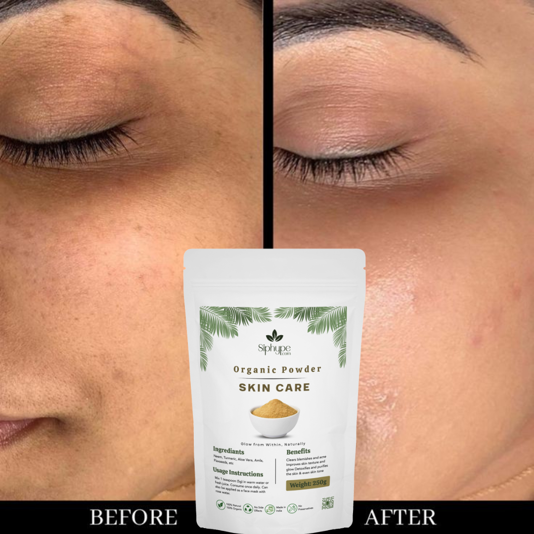 8-before after