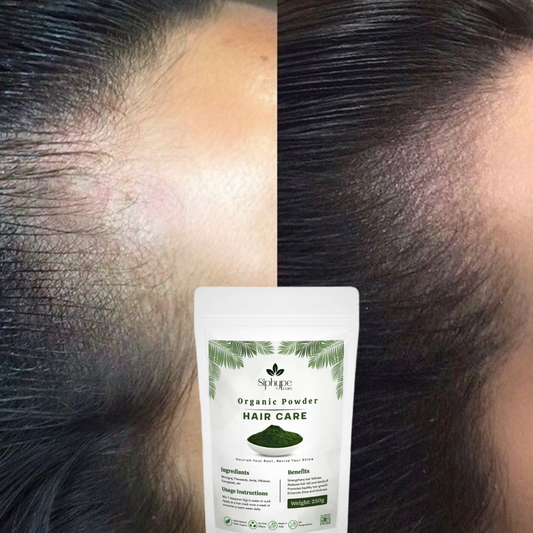9-before after